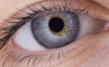 Génmutáció okozhatja a szem-melanomát 